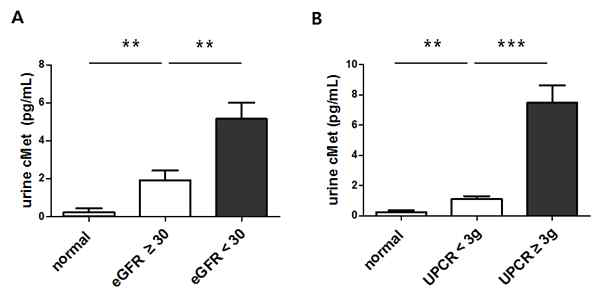 소변 cMet 농도와 신기능, 단백뇨와의 관계