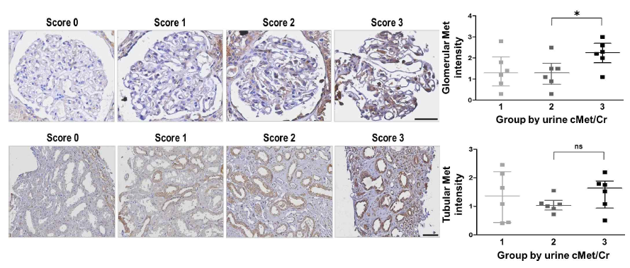 사구체 및 세뇨관 cMet 발현과 소변 cMet 농도와 상관관계