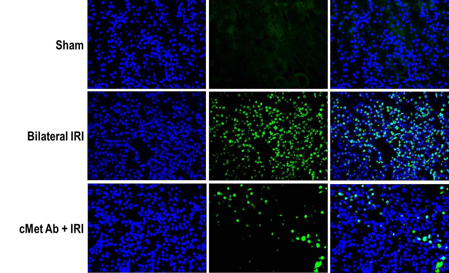 항체 투여 후 TUNEL 양성 세포의 감소