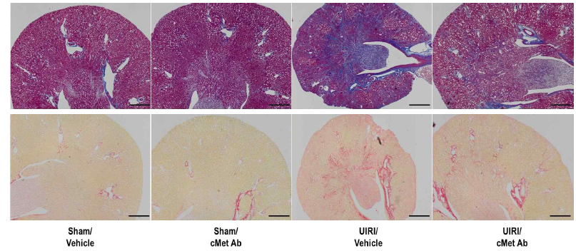 cMet agonistic 항체 투여 후 신장조직 섬유화의 호전 (MT stain, Sirius red stain)