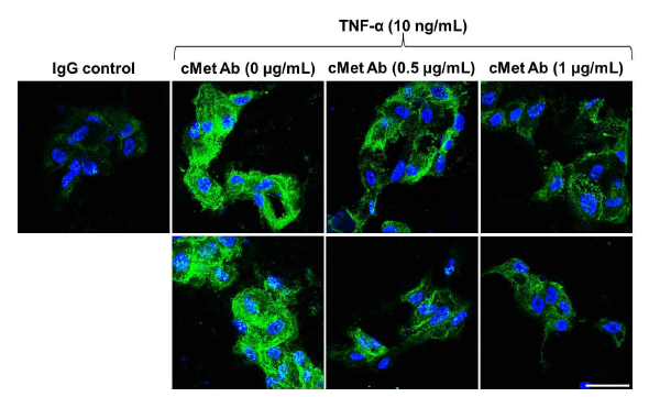 TNFα 자극으로 증가한 ICAM-1의 항체 투여 후 변화 확인