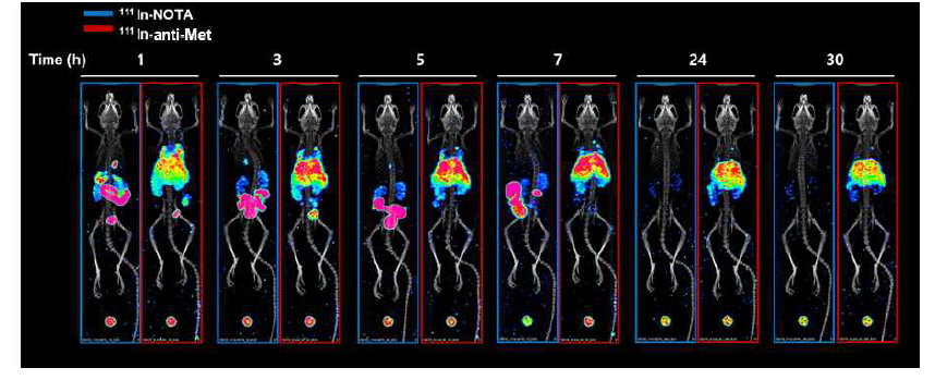 정상 마우스 생체 내 항체 분포 영상 대표 이미지; 111In-NOTA(왼쪽) vs. 111In-anti-Met(오른쪽)