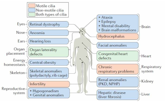 Ciliopathy가 초래하는 전신의 증상 및 질병