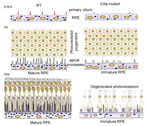 Ciliopathy에 의한 망막변성 과정