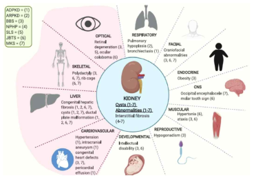 Renal ciliopathy의 다양한 extrarenal phenotypes