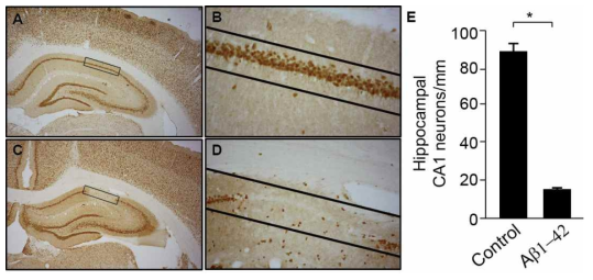 Amyloid beta (Aβ1-42) 주입에 의한 해마 신경세포의 사멸 유발 관찰