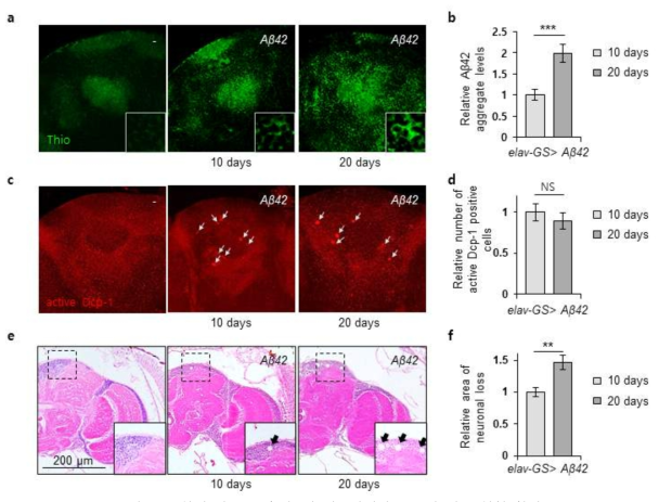 노화에 따른 Aβ축적, 뇌 세포사멸과 스폰지 뇌 표현형 확인