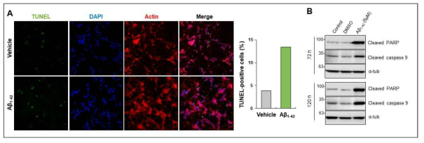 Aβ1-42 oligomer에 의한 신경세포사멸