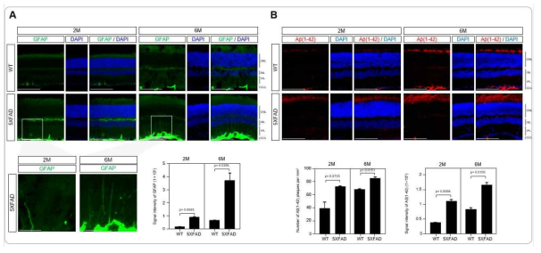 마우스 망막에서의 뮬러 신경교 세포 마커인 GFAP 및 아밀로이드 베타의 발현 (A) 망막에서의 신경교 세포 마커로 GFAP이 발현 검증 (B) 망막에서의 GFAP이 발현 검증