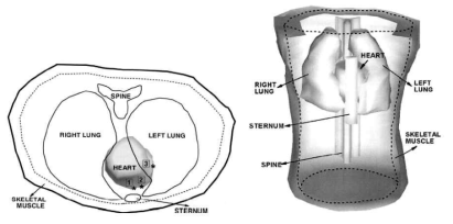흉곽(torso)의 전기파동 현상에 대한 해석모델 예시