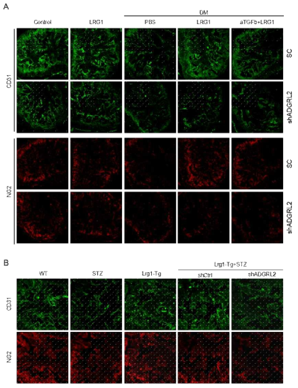 당뇨 마우스에서 LRG1-ADGRL2 경로가 음경 혈관내피세포와 혈관주위세포에 미치는 영향 검증. LRG1 단백질에 의한 음경 혈관내피세포 및 혈관주위세포 재생 효과가 ADGRL2 발현 저해 시 나타나지 않음 (A, B)
