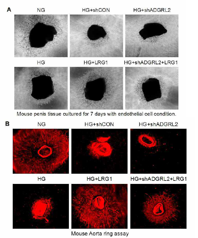 당뇨조건에서 ADGRL2를 통한 LRG1의 내피세포 발아 유도 효과. 고농도 글루코오즈 조건에서 감소한 내피세포 발아가 LRG1 단백질에 의해 증가하였고, ADGRL2 발현 저해 시 LRG1 단백질에 의한 내피세포 발아 효과가 감소함 (A, B)