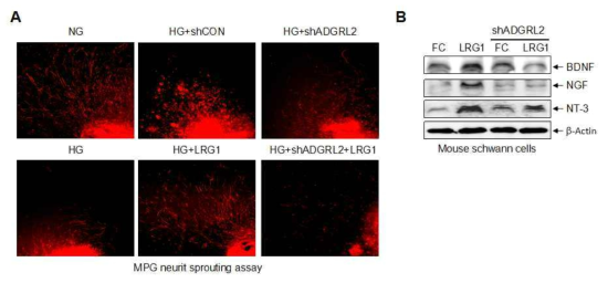 당뇨조건에서 ADGRL2를 통한 LRG1의 신경 재생 효과. 고농도 글루코오즈 조건에서 저해되었던 신경 재생이 LRG1 단백질에 의해 증가하였고, ADGRL2 발현 저해 시 LRG1 단백질에 의한 신경 재생이 감소함 (A). Schwann cell에서 LRG1 단백질에 의해 신경재생 인자의 발현이 증가하였고, ADGRL2 발현 저해 시 신경재생 인자 발현이 감소함 (B)