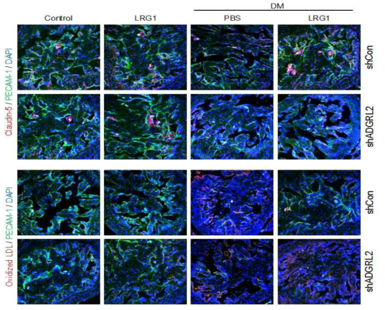 당뇨 마우스에서 LRG1 단백질에 의한 혈관손상 저해 효과. 당뇨 마우스에서 감소되었던 claudin-5 발현이 LRG1 단백질에 의해 회복됨. 당뇨 마우스에서 증가되었던 oxidized-LDL 발현이 LRG1 단백질에 의해 감소되었고, shADGRL2 주입 시 LRG1 단백질의 작용이 억제됨