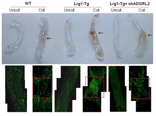 손상된 좌골신경에서 LRG1-ADGRL 경로에 의한 혈관 재생 확인. WT 마우스에 비해 LRG1-Tg 마우스 좌골신경에서 혈관재생 정도가 높았고, ADGRL2 shRNA 투여 시 혈관재생 효과가 감소됨
