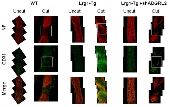 손상된 좌골신경에서 LRG1-ADGRL 경로에 의한 혈관 및 신경 재생 확인 (신경 손상 후 5일째 조직). WT 마우스에 비해 LRG1-Tg 마우스 좌골신경에서 혈관 및 신경재생 정도가 높았고, ADGRL2 shRNA 투여 시 혈관재생 효과가 감소됨