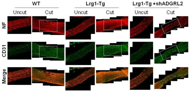손상된 좌골신경에서 LRG1-ADGRL 경로에 의한 혈관 및 신경 재생 확인 (신경 손상 후 14일째 조직). WT 마우스에 비해 LRG1-Tg 마우스 좌골신경에서 혈관 및 신경재생 정도가 높았고, ADGRL2 shRNA 투여 시 혈관재생 효과가 감소됨