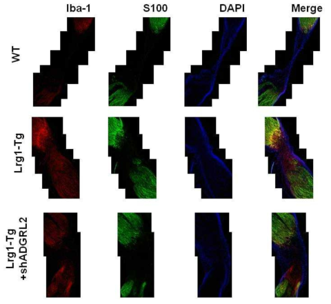 손상된 좌골신경에서 macrophage 및 schwann 세포의 발현. WT 마우스에 비해 LRG1-Tg 마우스에서 신경 손상 부위에 Iba-1 및 S100 발현이 높았고, ADGRL2 shRNA 투여 시 발현이 감소됨