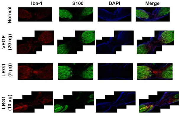 손상된 좌골신경에서 macrophage 및 schwann 세포 분포에 대한 LRG1 단백질의 효과 확인. 손상된 신경 부위에서 LRG1 단백질에 의한 높은 Iba-1 발현을 보임