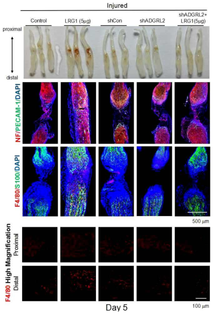 마우스 좌골신경손상모델에서 LRG1단백질 투여를 통한 혈관 및 신경재생 유도효과