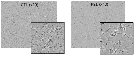 각 아형별 분화된 신경세포의 대표 이미지. Ctl, control iPSC-derived neuron (AD-CTL-CHA11-NPC); PS1, PSEN1 mutation (S107F) iPSC-derived neuron (fAD-PS1-CHA07-NPC)