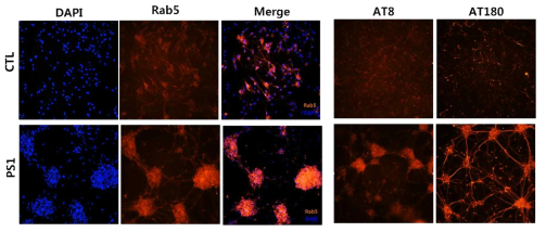 Control과 PS1 iPSC-derived neuron에서 주요 유전자 (Rab5, pTau) 발현 평가