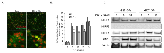 ApoE4 환자 iPSC-derived neuron에서 염증관련 유전자 평가 결과