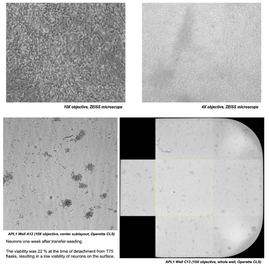 새로운 세포주의 배양과 transfer 시의 문제점. 위쪽 사진: 알츠하이머병 세포주의 75T flask에서의 신경세포 분화 2주차. 세포활성도에 문제없음; 아래쪽 사진: 384 well plate로 분화중 세포를 transfer 한 후 일주일 경과시 심각하게 낮은 세포 활성도를 보임을 확인함