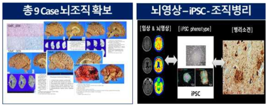 본 과제를 통해 추후 뇌영상 – iPSC – 조직병리 연구 기반 마련