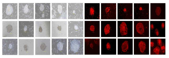 확립된 iPSC 3종의 Single Colonies (Clones)