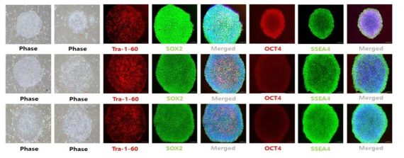 확립된 3종의 환자 유래 유도만능줄기세포주의 특성 분석