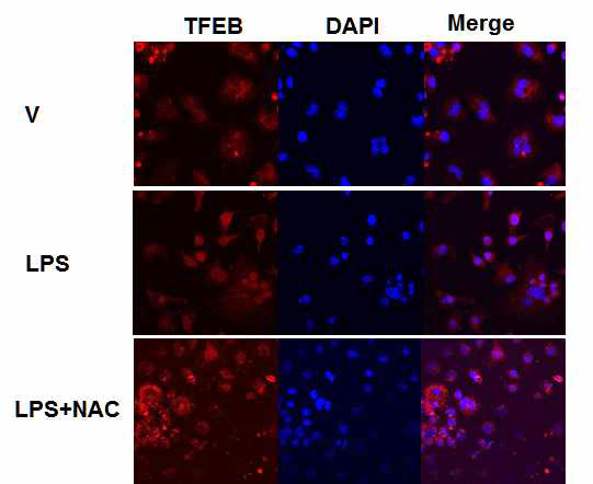 파골세포분화시 LPS자극에 의해 TFEB의 핵으로 이동 증가 하고 ROS 제거시 (NAC처리) 감소함. (confocal Microscopy). NAC,N-acetylcysteine (ROS scavenger)