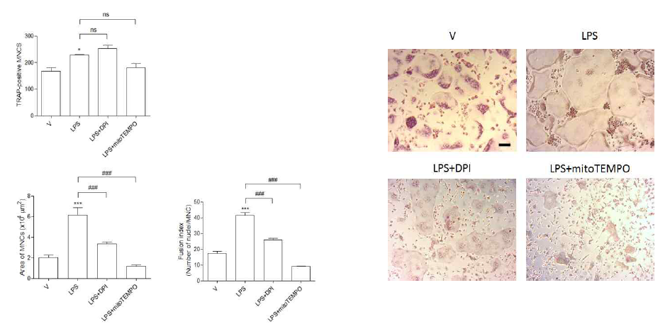 파골세포분화시 LPS에 의해 증가된 파골세포분화가 cytoplasmic ROS와 motochodrial ROS를 차단시 파골세포의 수는 변화가 없으나 파골세포의 면적과 fusion index를 현저히 저해함