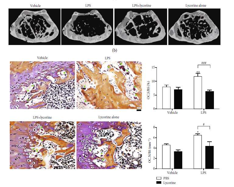 lycorine은 LPS 의한 골소실을 완화시키고 이는 파골세포에서의 작용에 의함