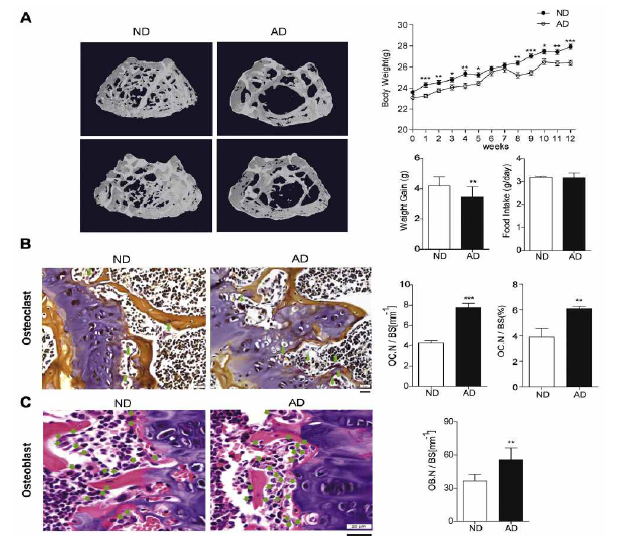 atherogenic diet, 12주후 uCT (A), in vivo TRAP staining (B), H&E staining (C)