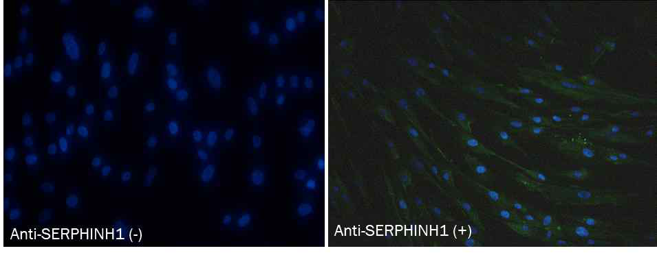 배양된 fibroblast에서 SERPHINH1의 발현 확인