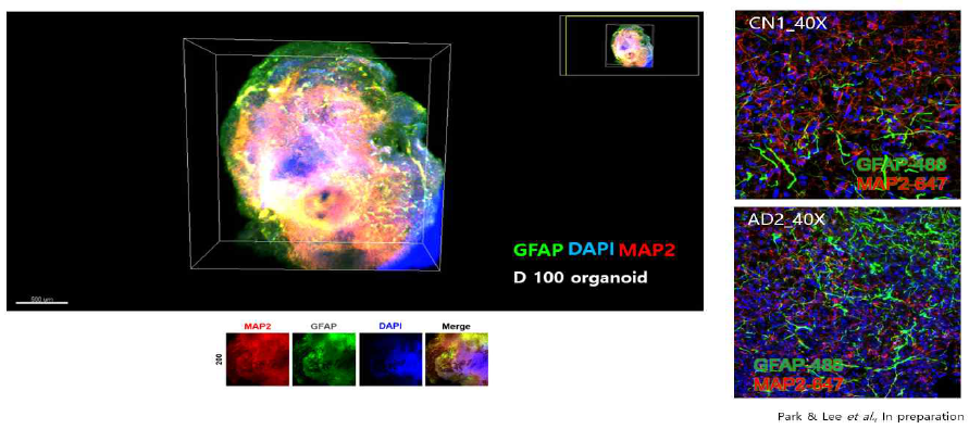 오가노이드에서의 신경세포 (Neuron) 및 성상교세포(Astrocyte)의 확인