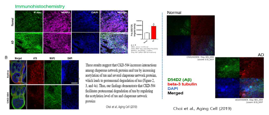 알츠하이머병 오가노이드에서 타우 및 아밀로이드 베타 단백질이 증가됨을 이미지 (IHC) 로 확인 (Choi et al., Aging Cell (2020) Jan;19(1):e13081.Epub 2019. Nov 25