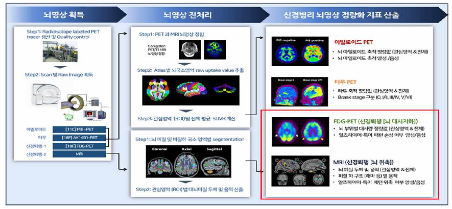 KBASE 뇌영상 획득- 전처리- 정량화 지표산출 과정