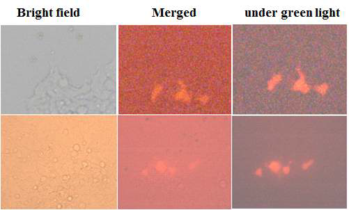 transfection 후 2일 경과된 293T cell의 red florescent 세포주