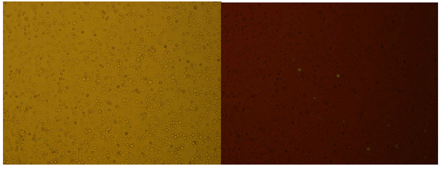 Transfection이 확인된 세포주. bright field(좌)와 GFP 발현(우)
