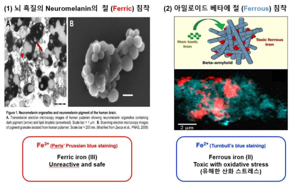 뇌 조직내 존재하는 철 복합체의 예