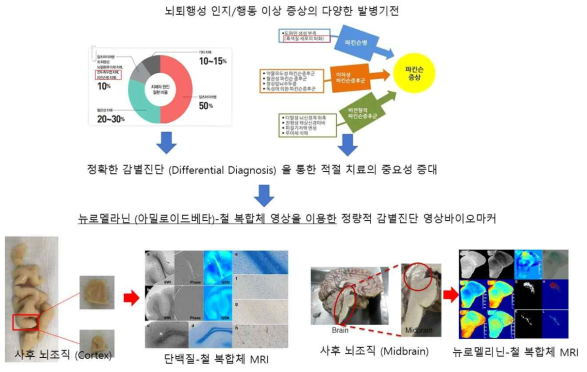 본 과제에서 개발하고자 하는 퇴행성 뇌질환 영상 바이오마커 개요