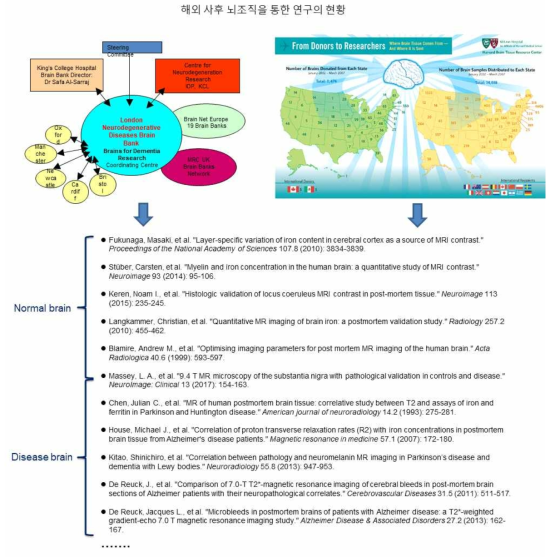 사후 뇌조직을 이용한 해외 연구 사례