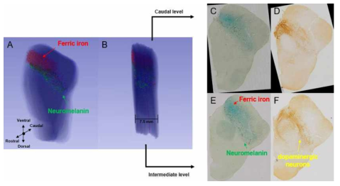 3차원으로 복원된 중뇌 조직 내 뉴로멜라닌 색소의 분포