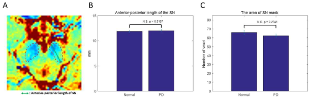 임상용 3T MRI에서 정상군과 파킨슨 환자군의 흑질 크기 비교