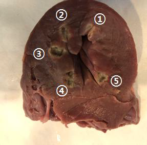 Endocardium ② ablation test