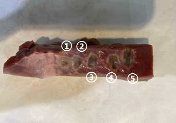 Epicardium ① ablation test