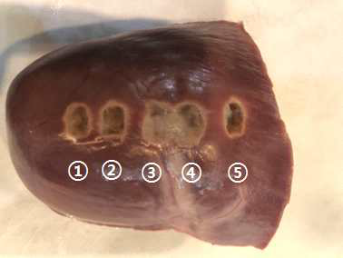 Epicardium ② ablation test