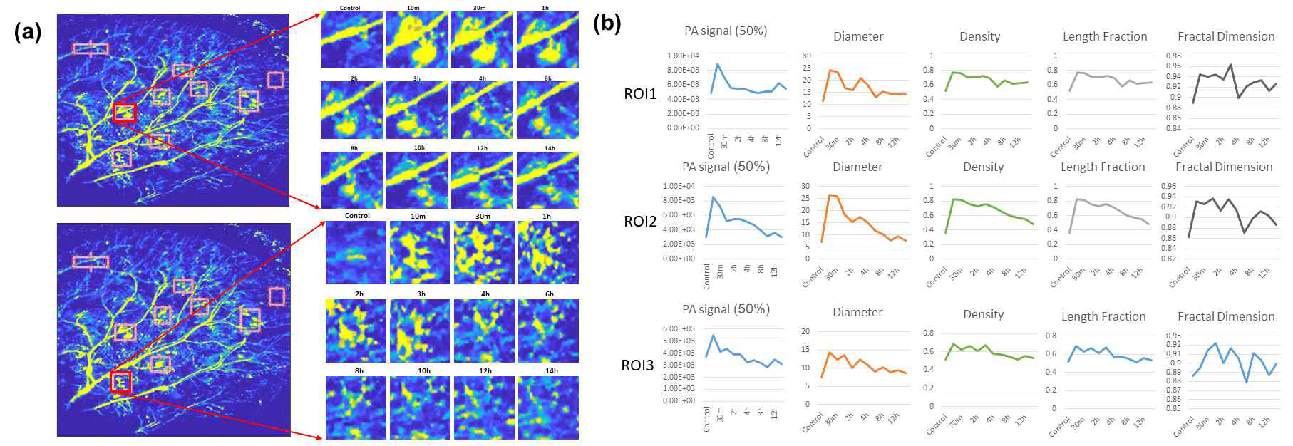 약물 주입에 따른 동물 생체 내 혈관 변화 관찰 연구. (a) 획득된 시간별 쥐 귀의 광음향 영상과 분석 영역, (b) 관심 구역별 (ROIs) 정량적 정보